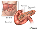 Pancreatitis - series