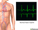 Normal heart rhythm