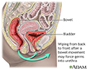 Prevention of cystitis