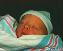 Jaundiced infant