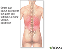 Backaches