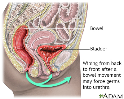 Prevention of cystitis