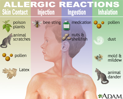 Allergic reactions