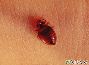 Bedbug - close-up