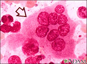 Osteoclast