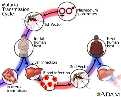 Malaria