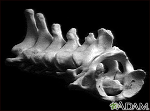 Vertebra, cervical (neck)