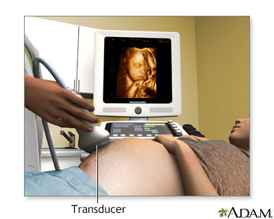 3D ultrasound