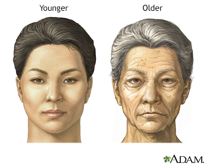 Changes in face with age