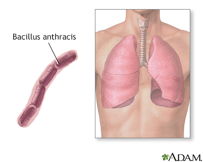 Bacillus anthracis