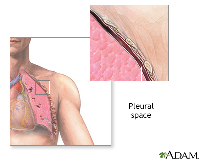 Pleural space