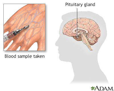 Growth hormone stimulation test