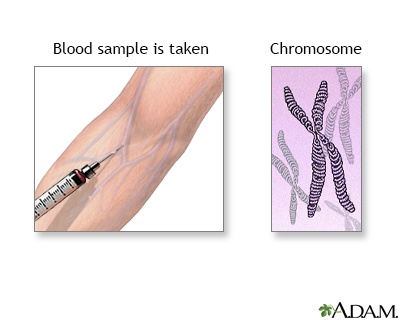 Karyotyping