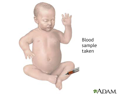 Infant blood sample