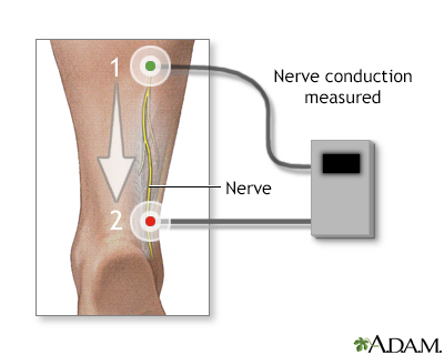 Nerve conduction test