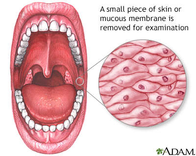 Mucosal biopsy